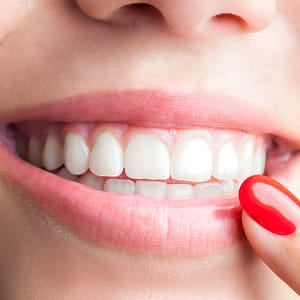 Choice Of Dental Service At Bettercare Medical Center Dubai Shafqa.com Online Shopping, Best Prices in Dubai UAE