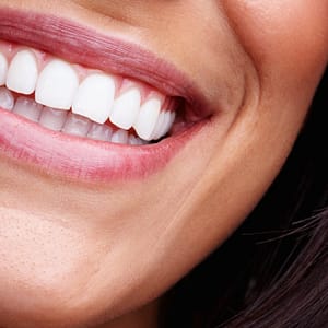 Dental Check-Up Dubai Shafqa.com Online Shopping, Best Prices in Dubai UAE