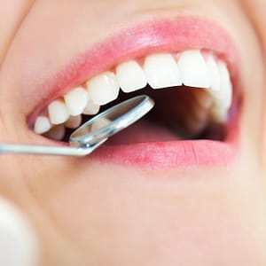 Checkup With Scale And Polish Dubai Shafqa.com Online Shopping, Best Prices in Dubai UAE