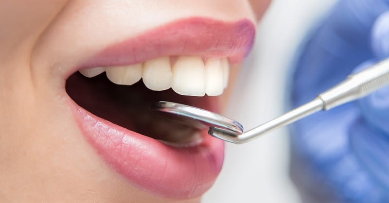 Choice Of Dental Treatment At Saphire Dent Dubai Dubai Shafqa.com Online Shopping, Best Prices in Dubai UAE 3