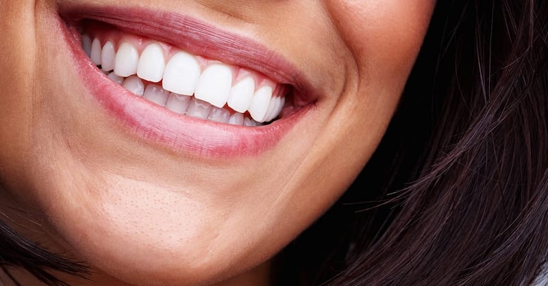 Dental Check-Up Dubai Shafqa.com Online Shopping, Best Prices in Dubai UAE 2