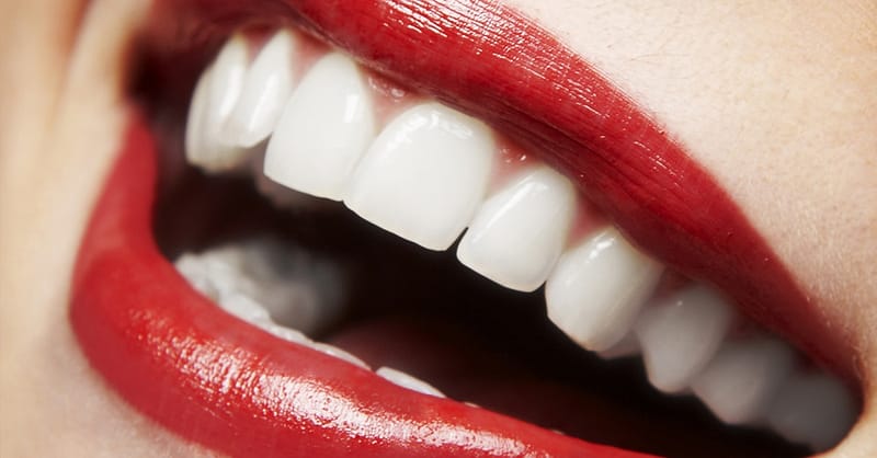 Dental Check-Up With Optional Stain Removal, Or Laser Teeth Whitening Dubai Shafqa.com Online Shopping, Best Prices in Dubai UAE 2