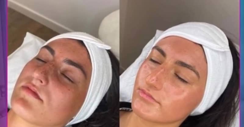 Facial – Anti-Ageing Dubai Shafqa.com Online Shopping, Best Prices in Dubai UAE 2