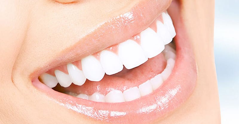 Scaling And Polishing With X-Ray At Omar Yahia Dental Surgery Clinic Dubai Shafqa.com Online Shopping, Best Prices in Dubai UAE 2