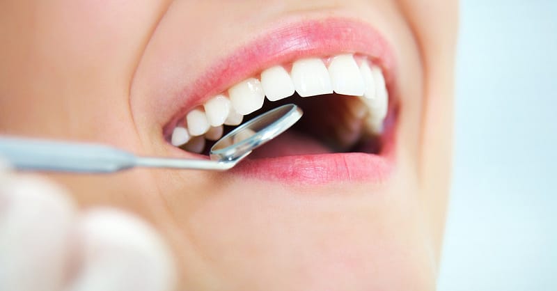 Checkup With Scale And Polish Dubai Shafqa.com Online Shopping, Best Prices in Dubai UAE 2