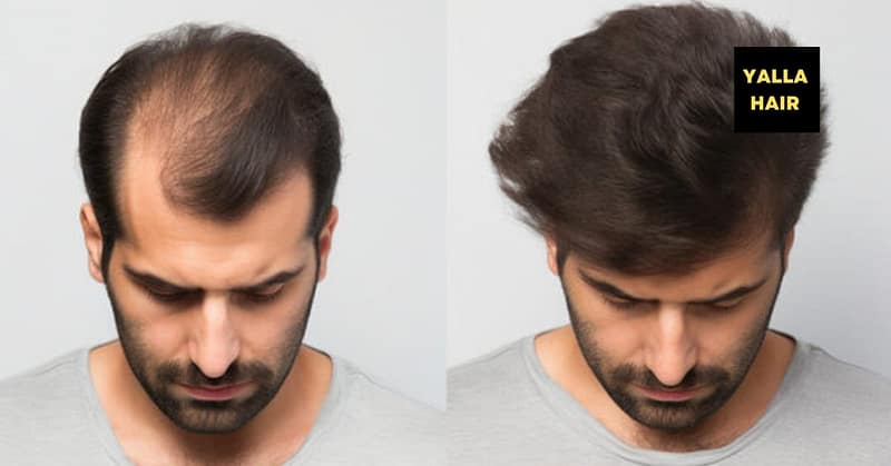 Extensions / Feathering Dubai Shafqa.com Online Shopping, Best Prices in Dubai UAE 2